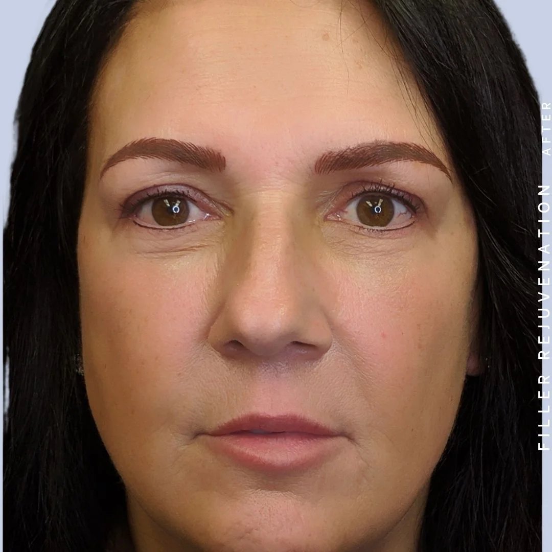 Global Before & After Gallery - Patient 108744249 - Image 2