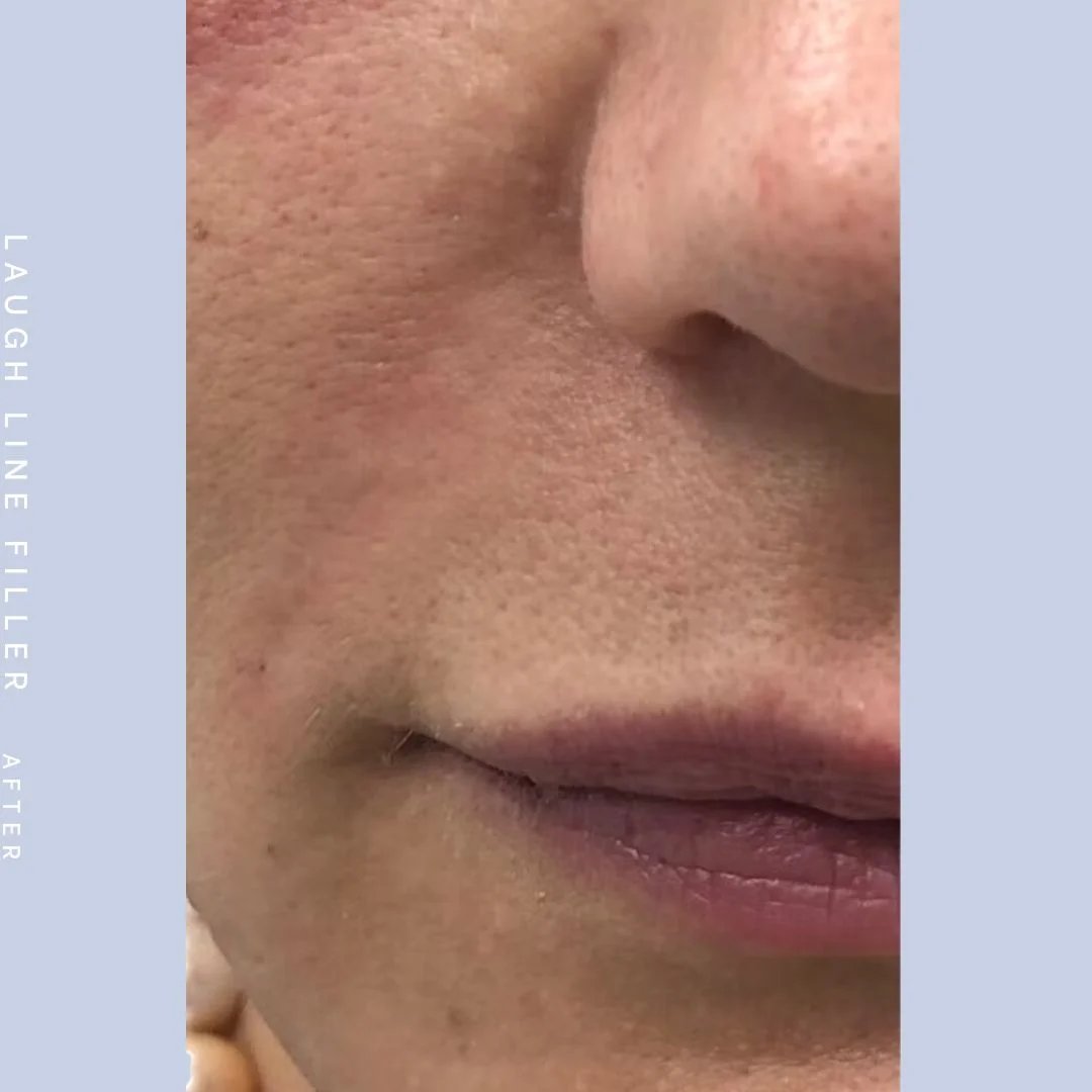 Mouth Before & After Gallery - Patient 108744453 - Image 2