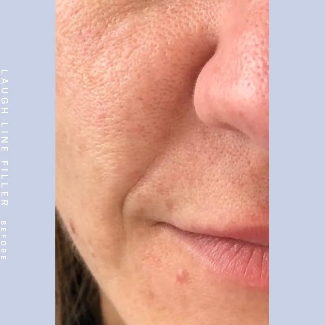 Mouth Before & After Gallery - Patient 121418566 - Image 1