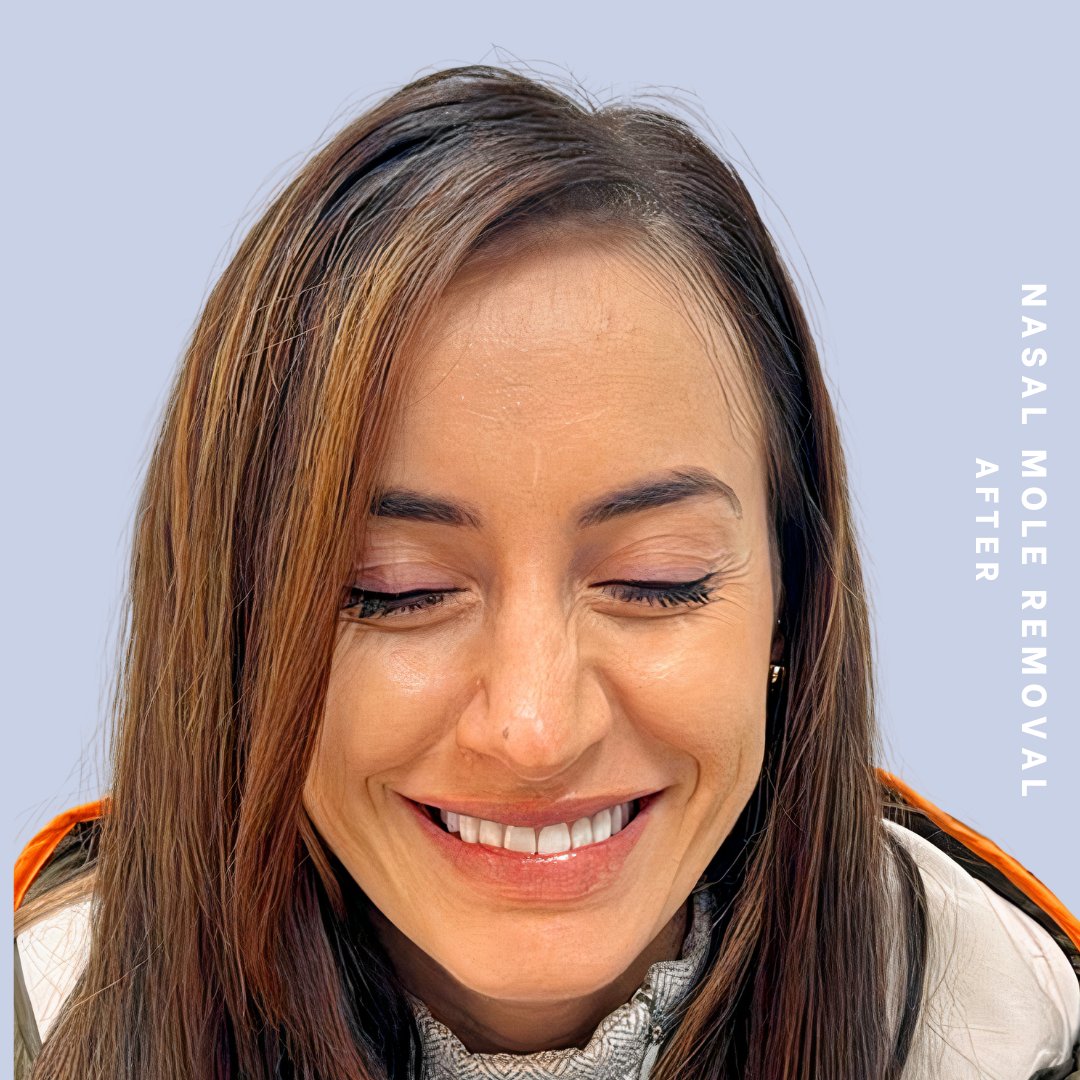 Other Before & After Gallery - Patient 146646072 - Image 2