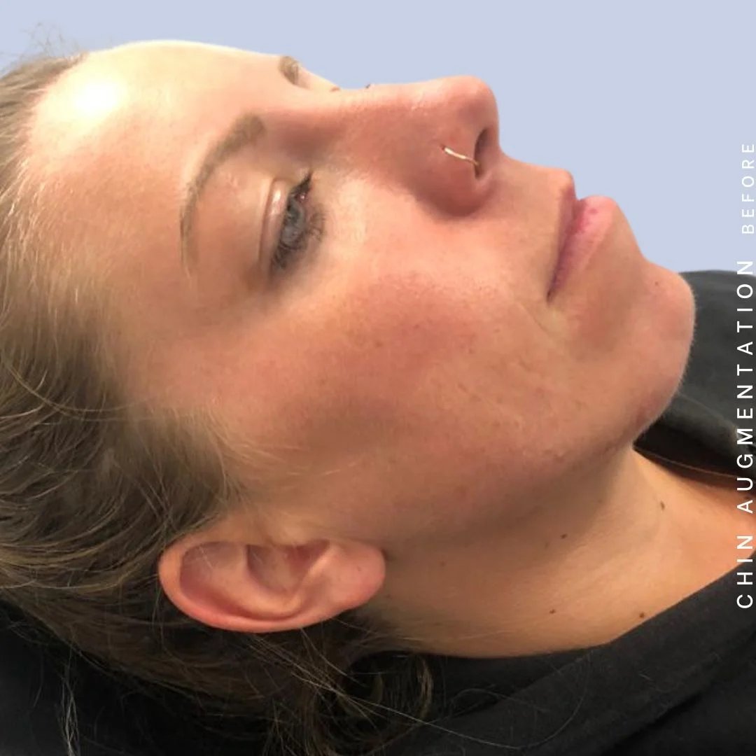 Mouth Before & After Gallery - Patient 146925211 - Image 1