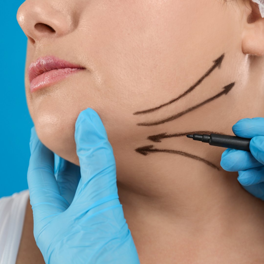 Dr. Hardik Doshi  Blog | Why Is Liposuction the Best Fat Removal Method