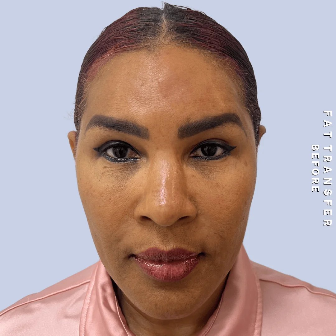 Other Before & After Gallery - Patient 277073 - Image 3