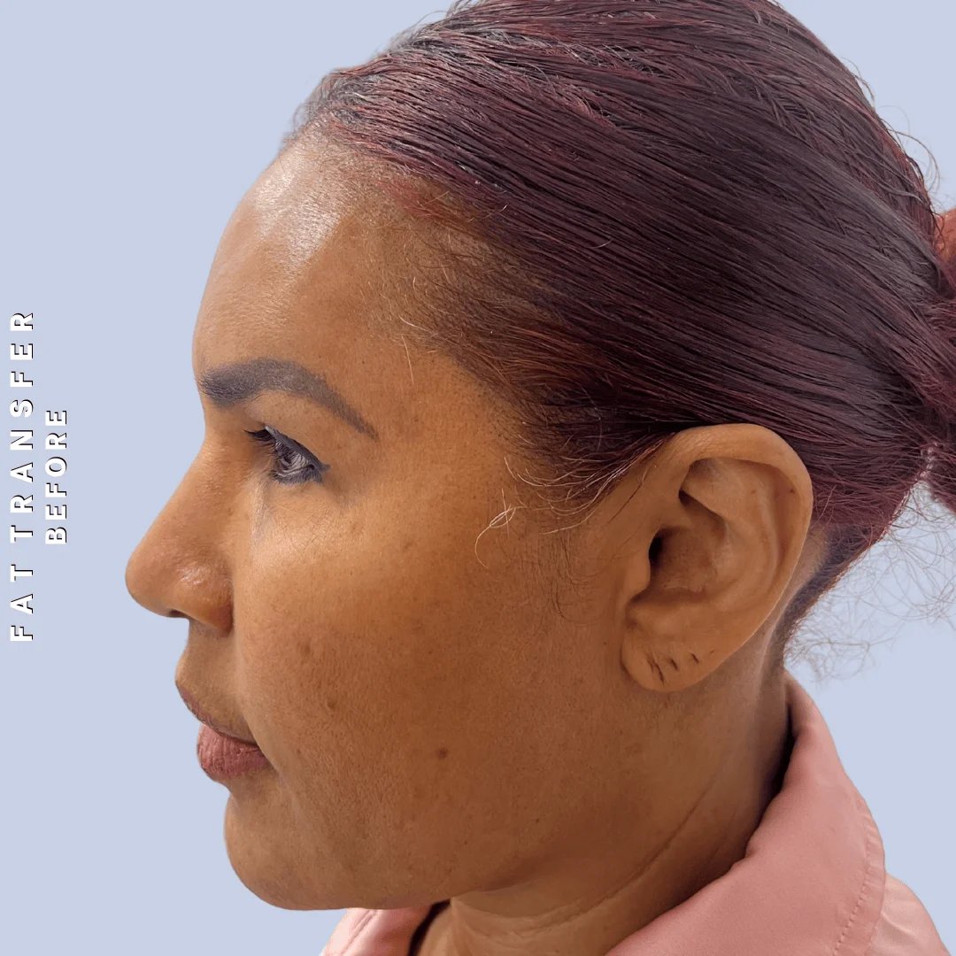 Other Before & After Gallery - Patient 277073 - Image 5