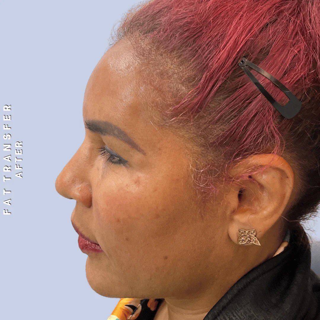 Other Before & After Gallery - Patient 277073 - Image 6