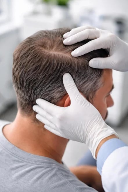 Clinician examining a patient's donor area during a long-term FUE follow-up