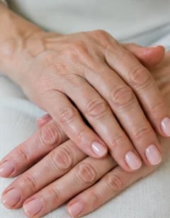 Close-up of hands showing volume loss and visible tendons